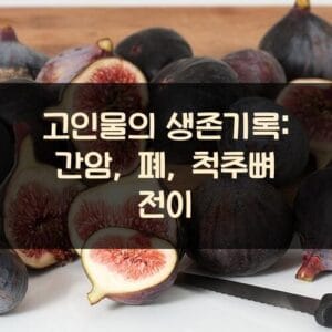 고인물의 생존기록: 간암, 폐, 척추뼈 전이 고인물의 생존기록: 간암, 폐, 척추뼈 전이